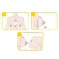 Suplementor - doplňkový systém ke kojení Medela